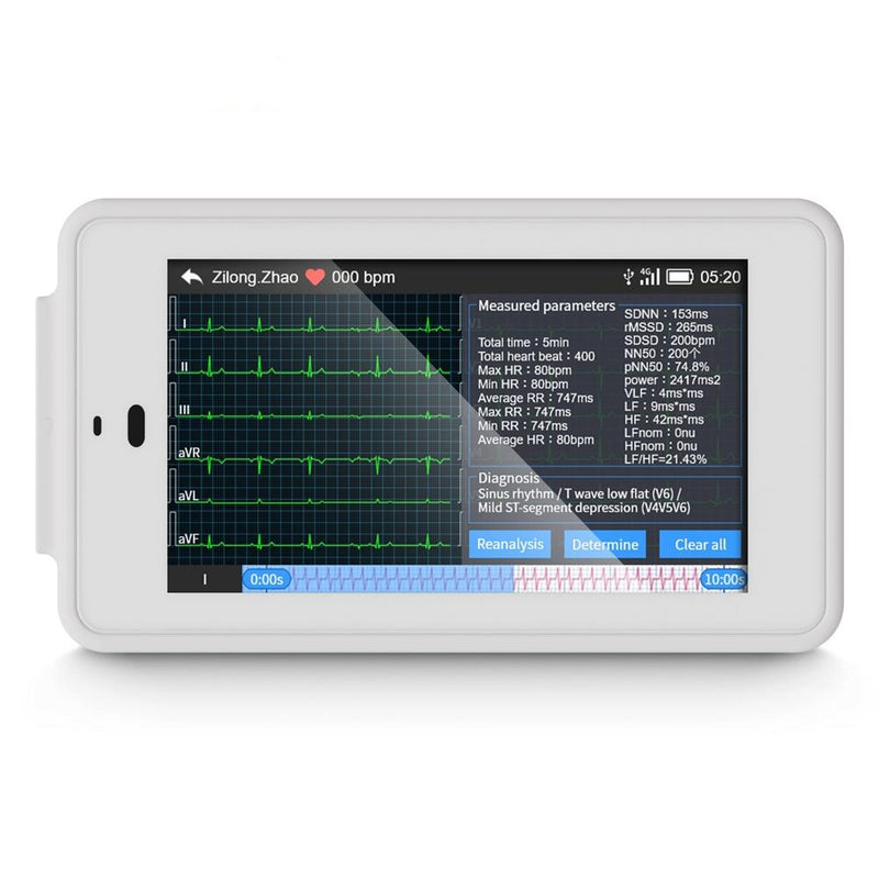 Portable PC-ECG500 12 Lead ECG Monitor Pocket ECG Machine with Glasgow Analysis