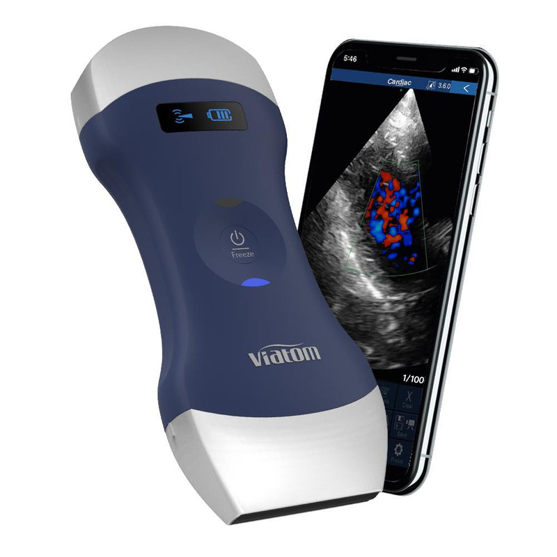 Professional Ultrasound Scanner Portable Doppler Whole Body Diagnostic Imaging WIFI Handheld Convex/Line Probe