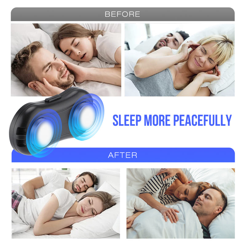 Smart Anti Snoring Device Portable EMS Pulse Noise Reduction Snore Stopper Health Care