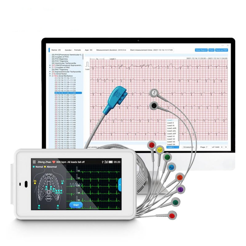 Portable PC-ECG500 12 Lead ECG Monitor Pocket ECG Machine with Glasgow Analysis
